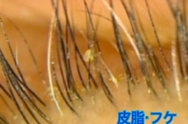 まつ毛を洗う 新習慣!!アイシャンプー